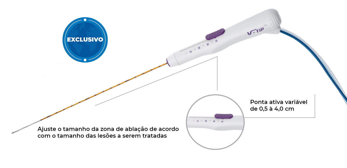 Ablação por radiofrequência